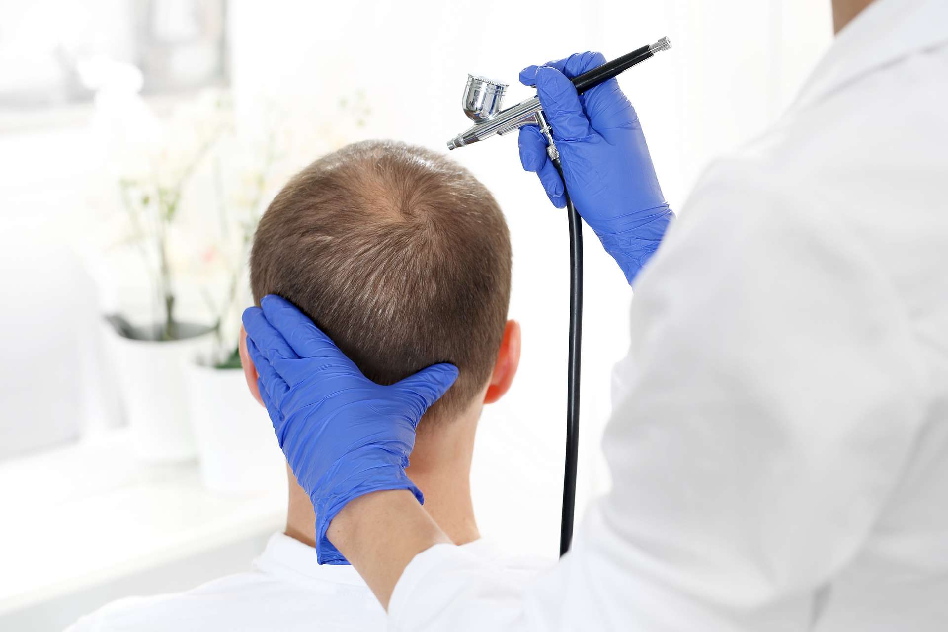 Infuzja tlenowa skóry głowy w Toruniu - zabieg oczyszczania skóry głowy